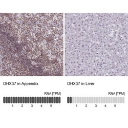 DHX37 Antibody, Novus Biologicals 25 &mu;L, Unlabeled:Antibodies, Polyclonal